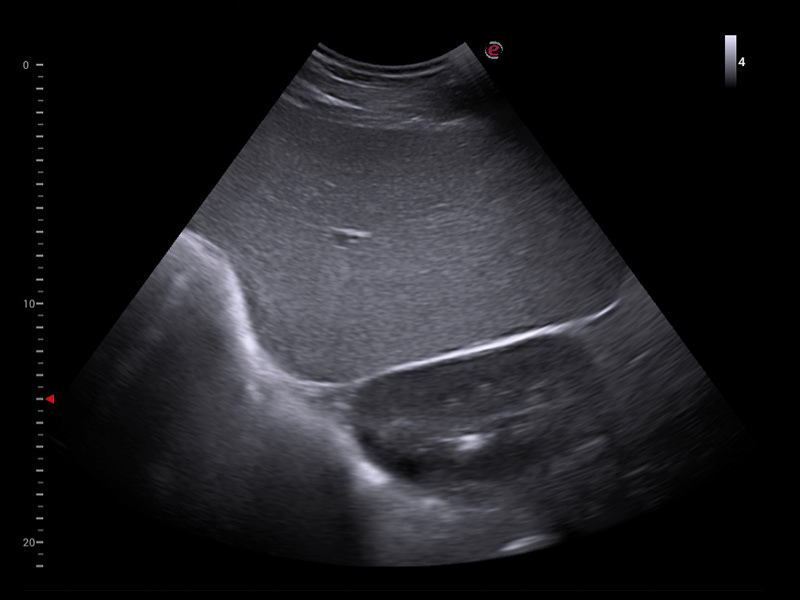 MyLab™X1VET - Equine - spleen and kidney