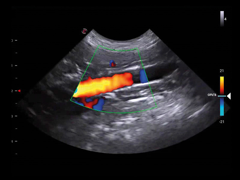 MyLab™X1VET - Dog - big vassels vascularization	