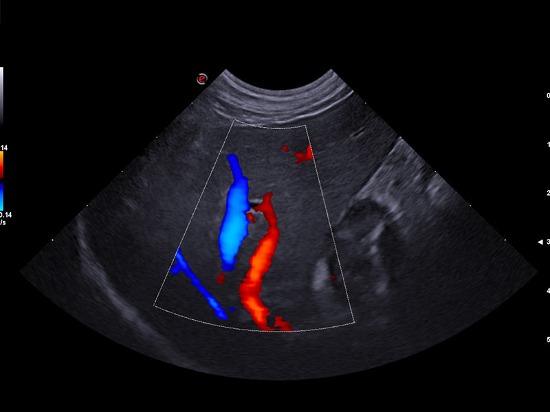 MyLab™X75VET - Dog - liver vascularization