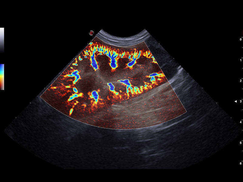 MyLab™X75VET - Dog - kidney vascularization with microV