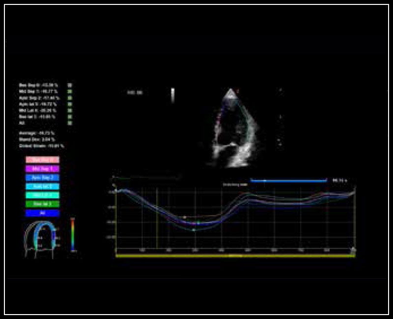 MyLab™X8VET - Dog - strain calculation with XStrain™