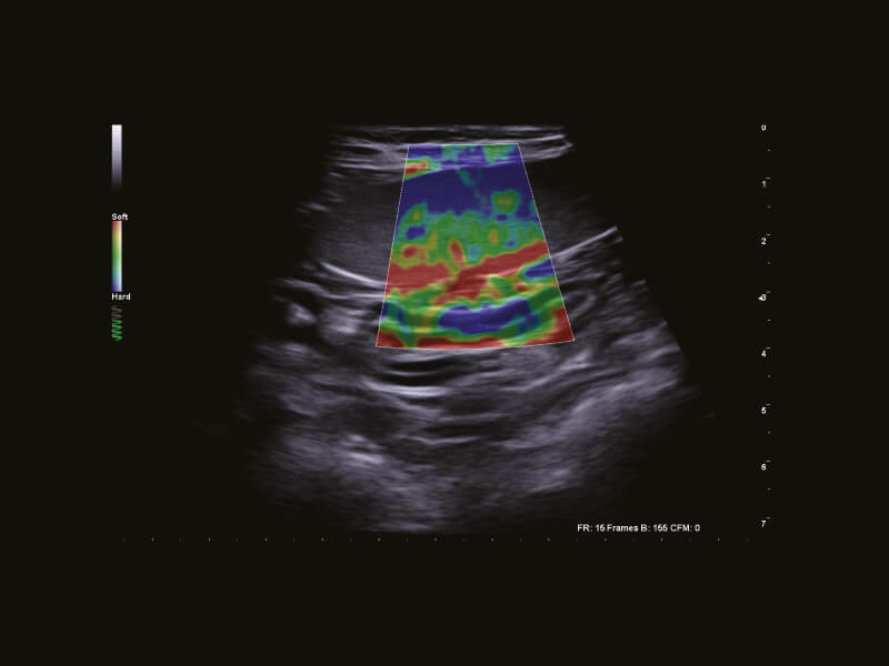 MyLab™Omega eXP VET - Dog - spleen elastosonography with ElaXto