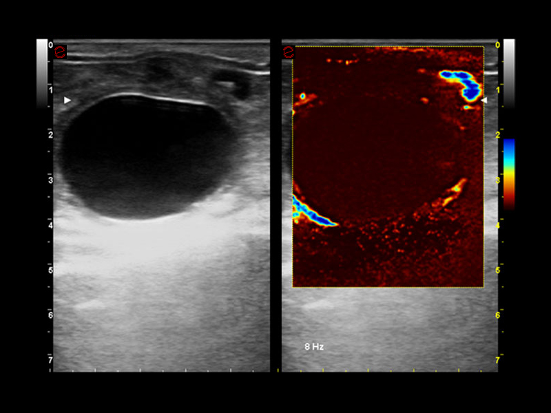 MyLab™Omega VET - Equine - dual mode ovary vascularization with microV