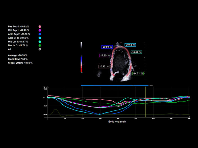 MyLab™X90VET - Dog - left ventricle wall motion assessment with XStrain™