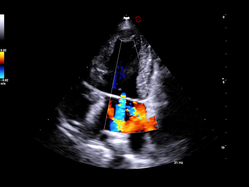 MyLab™FOX - Dog - mitral valve regurgitation flow