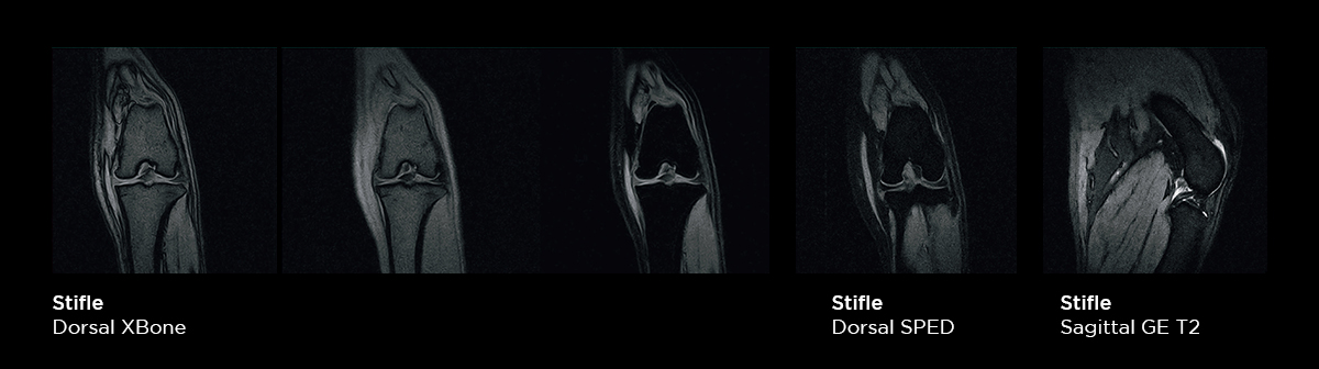 Joints MRI examination