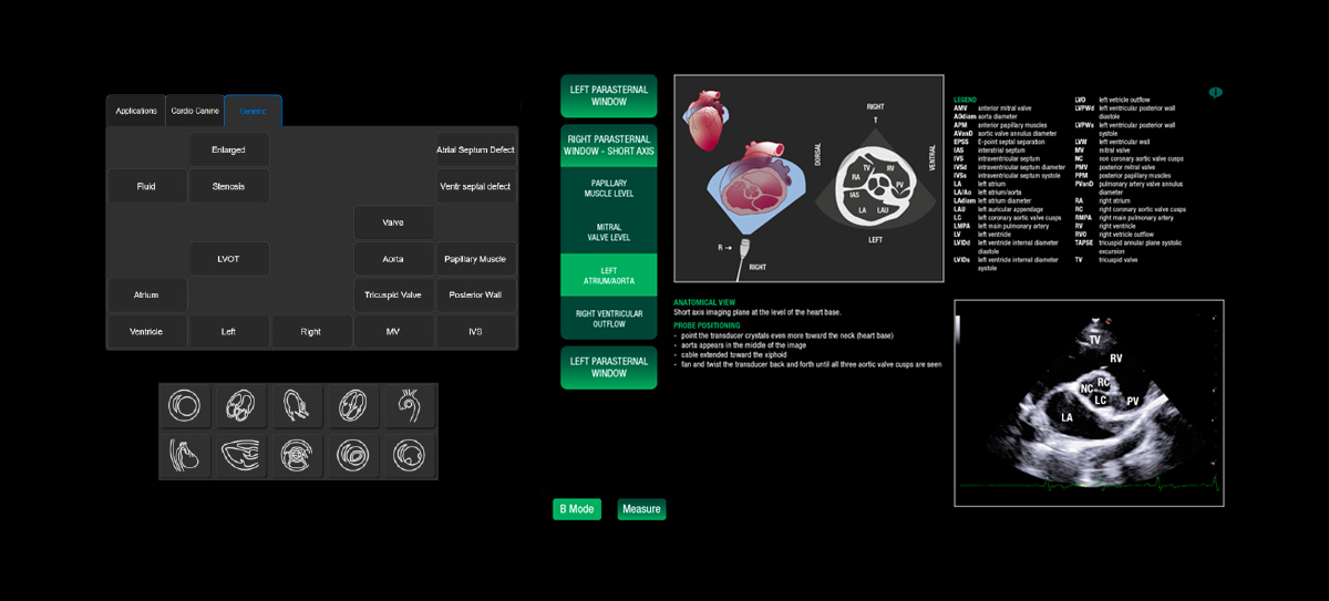 Dedicated VET workflow for cardiological examinations