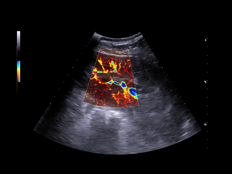 Equine clinical image - kidney vascukarization with microV