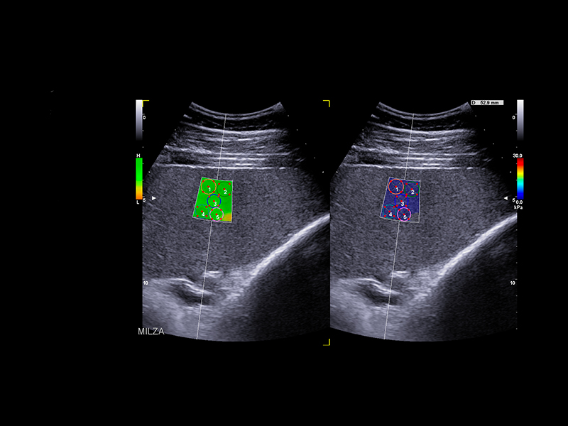 Equine clinical image - spleen stiffness assessment with QElaxto 2D