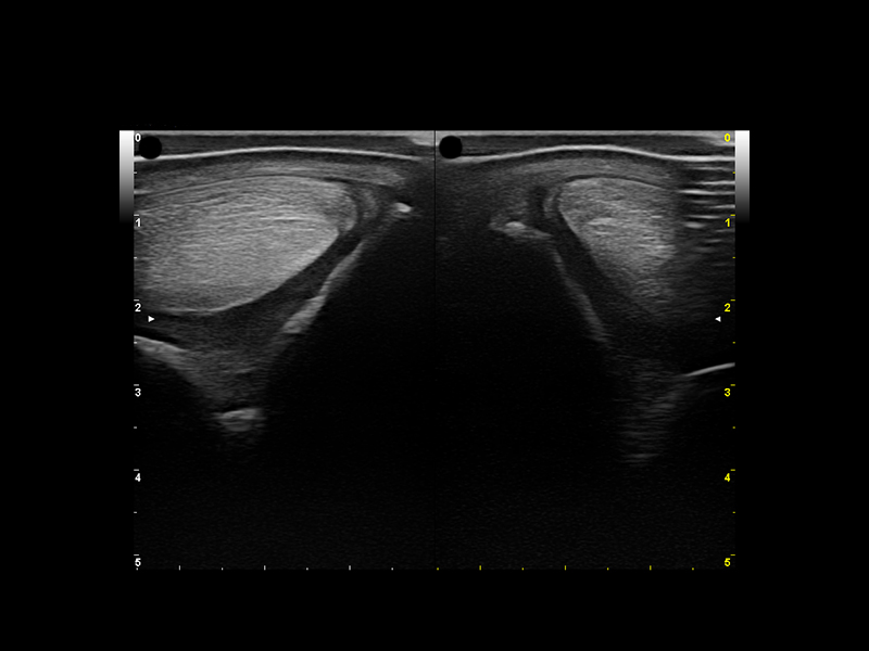 Equine clinical image - tendon 10