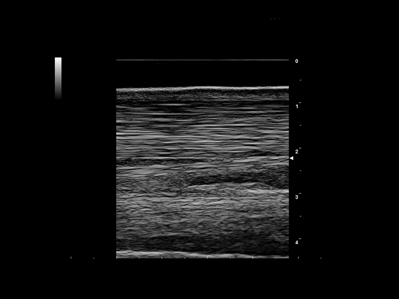 Equine clinical image - tendon 5