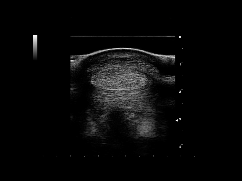 Equine clinical image - tendon 6