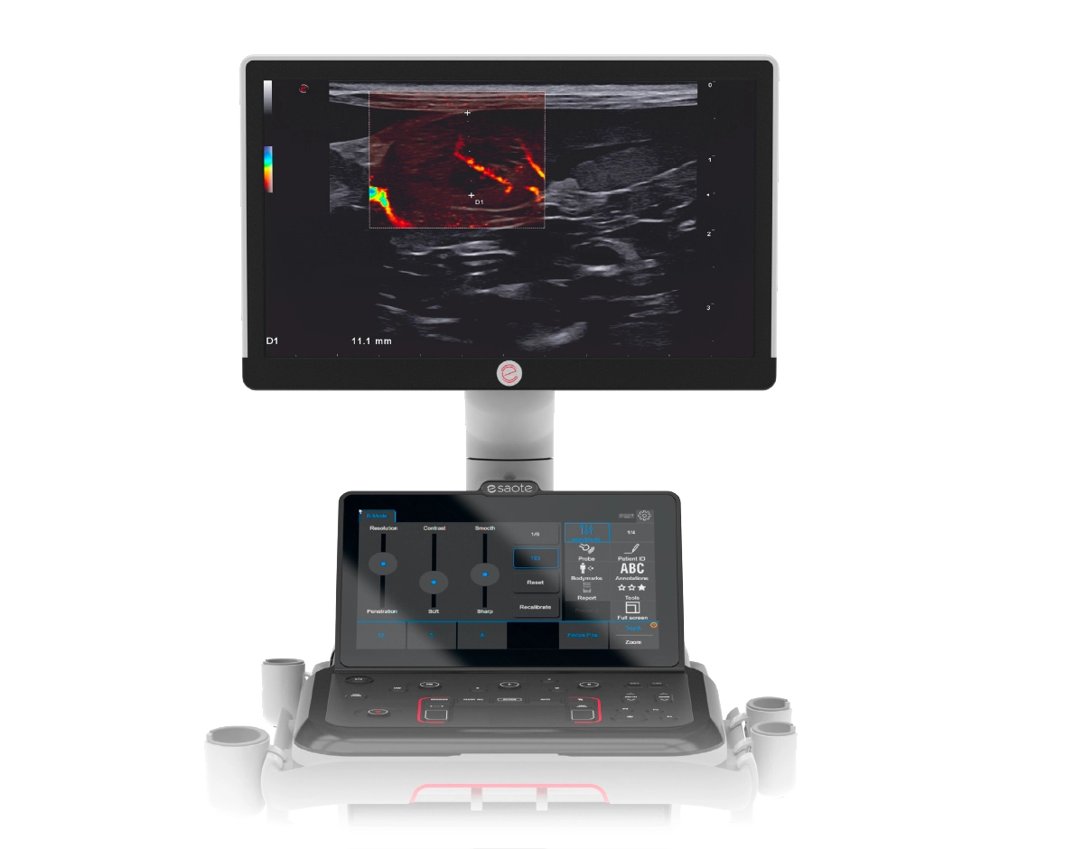 MyLab™FOX ultrasound