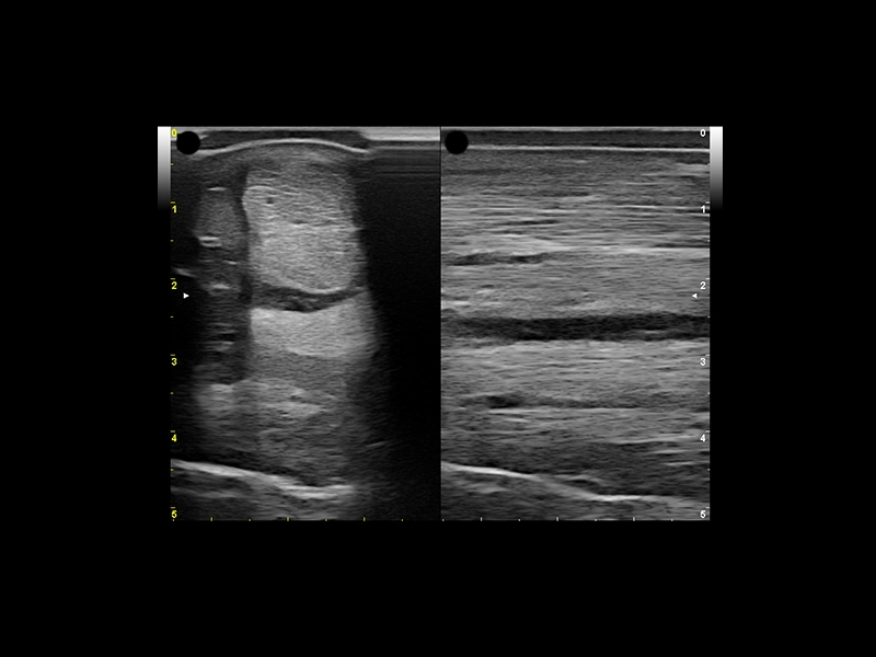 Equine clinical image - tendon 1