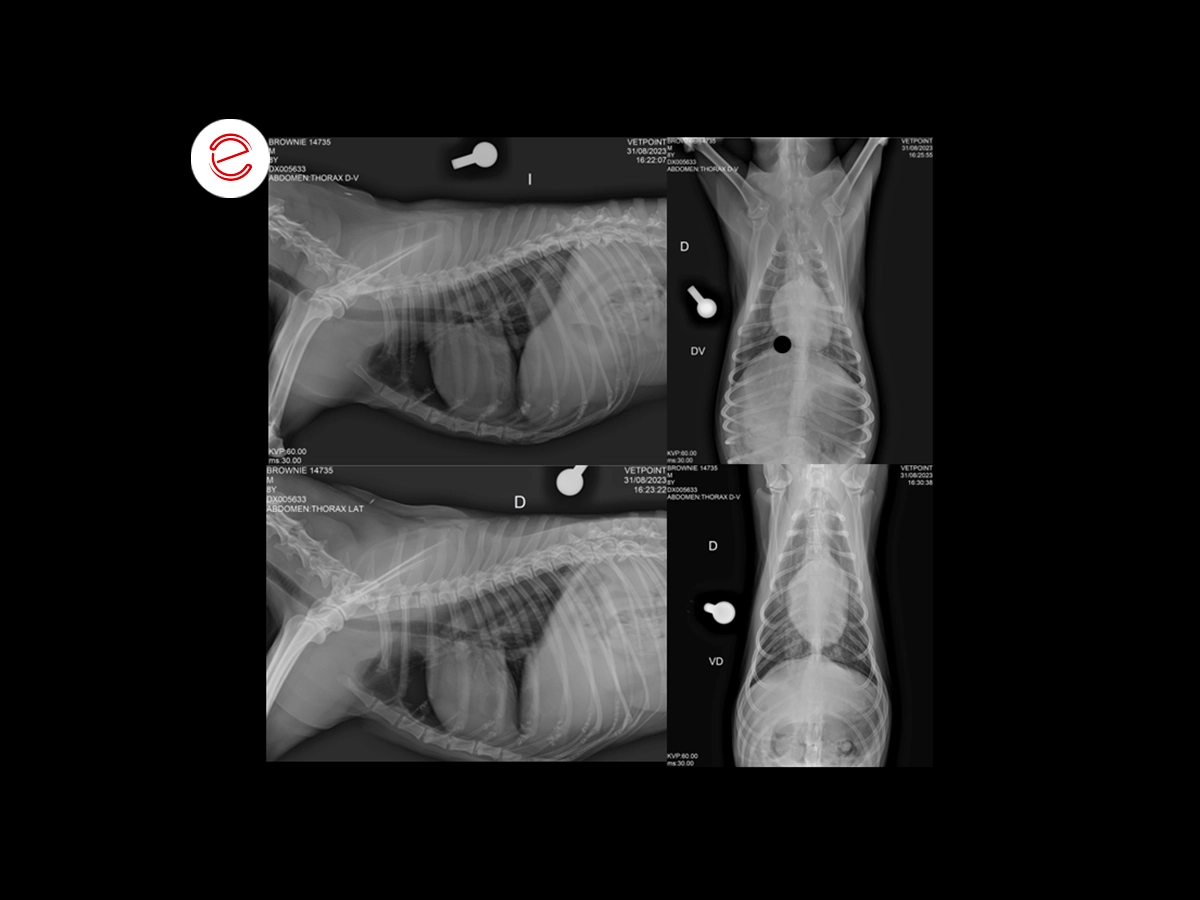 Chest X-ray analysis