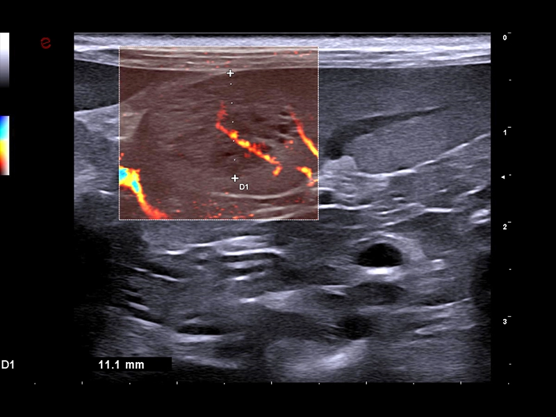 MyLab™FOX - Dog - vascularization with microV