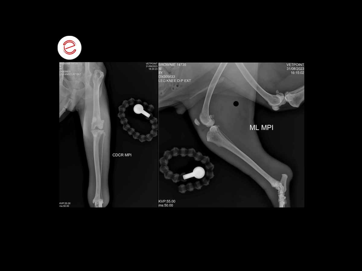 X-ray orthogonal projection of the knee