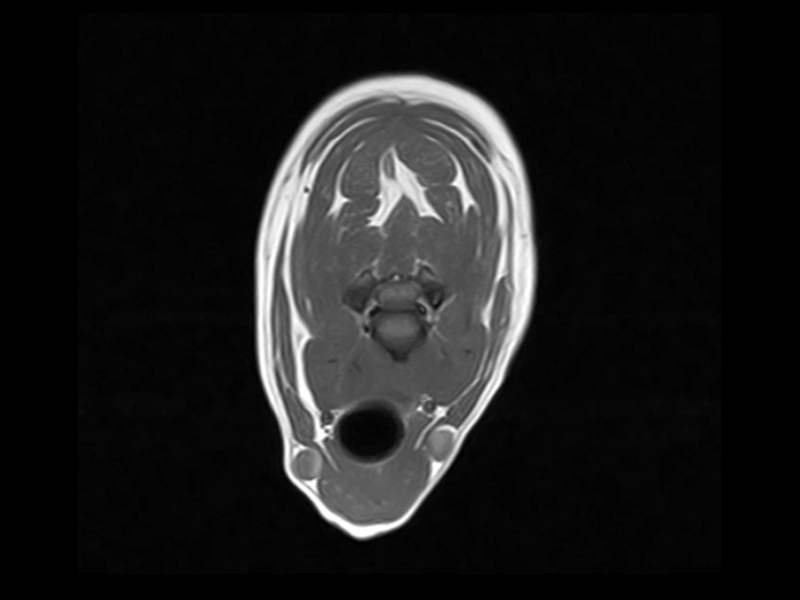 Vet-MR Grande - VG dog T1 AX cervico thoracic pulpy extrusion