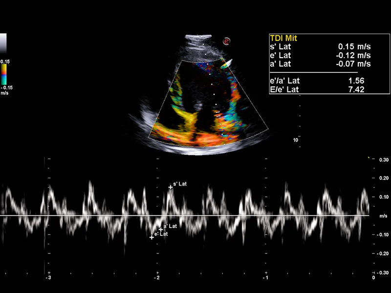 MyLab™X75VET - Dog - TDI study with TVM