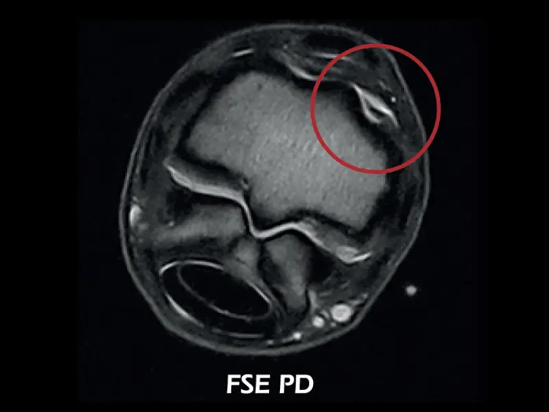 O-scan VET - Fetlock Arthropathy 03