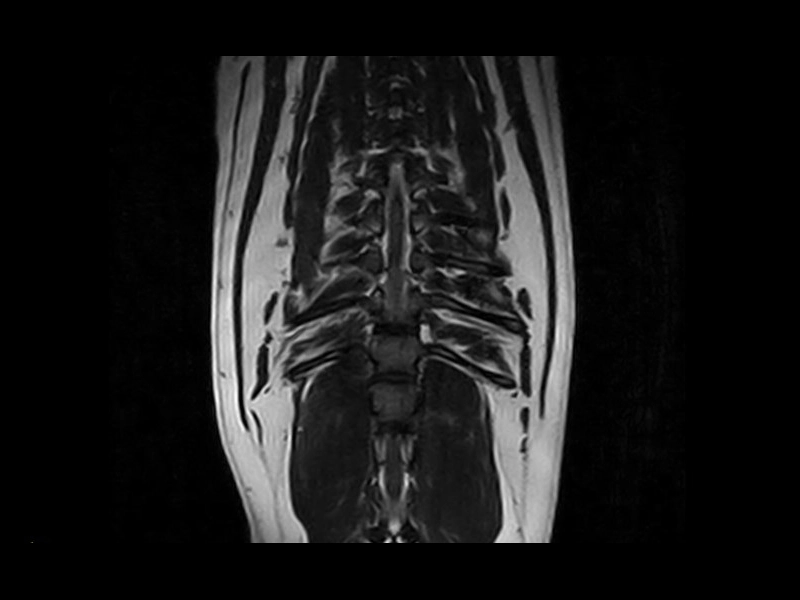 Vet-MR Grande - 3DHyce cor dog thoracolumbar