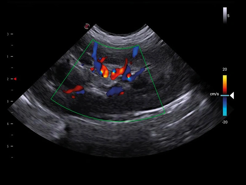 MyLab™X1VET - Dog - kidney vascularization