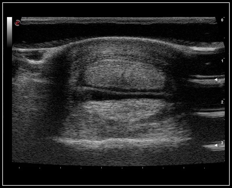 MyLab™SigmaVET - Equine - dgital tendons