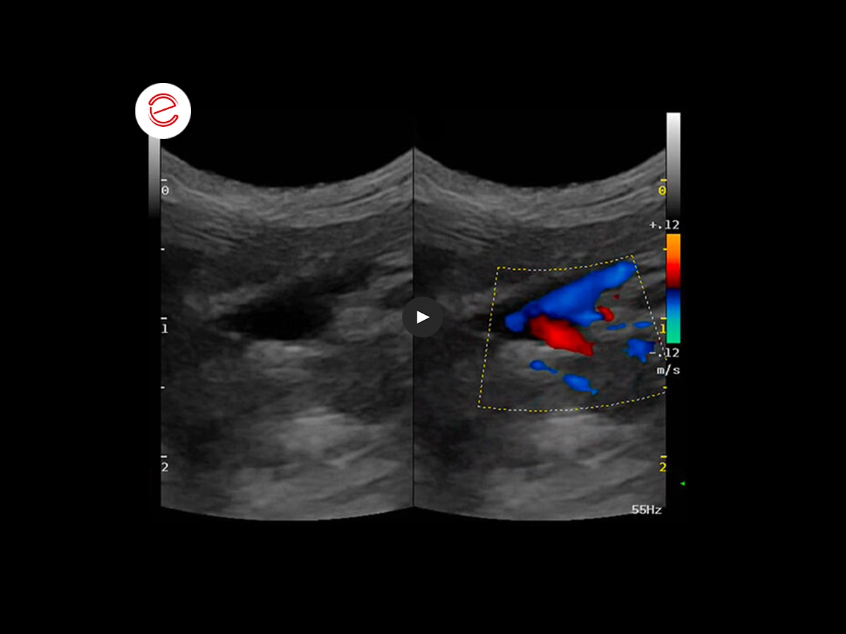 Canine ultrasonography 10