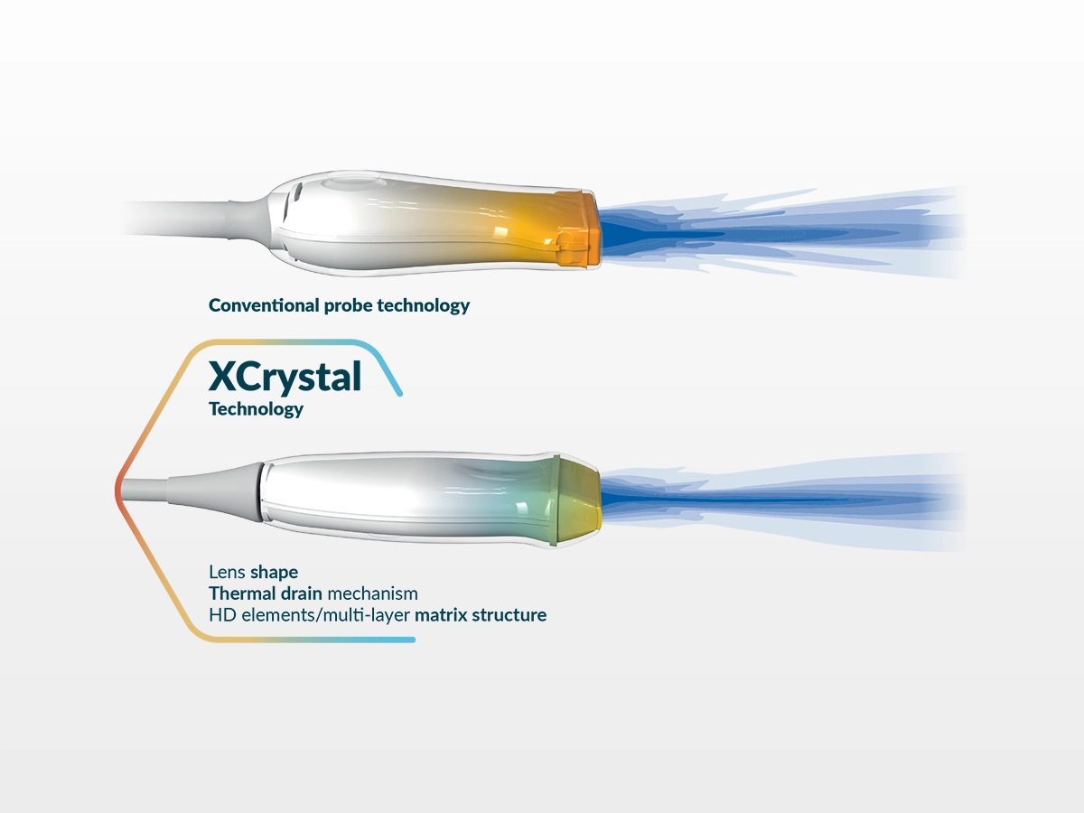 XCrystal Technology, Esaote's Advanced Probes Technology