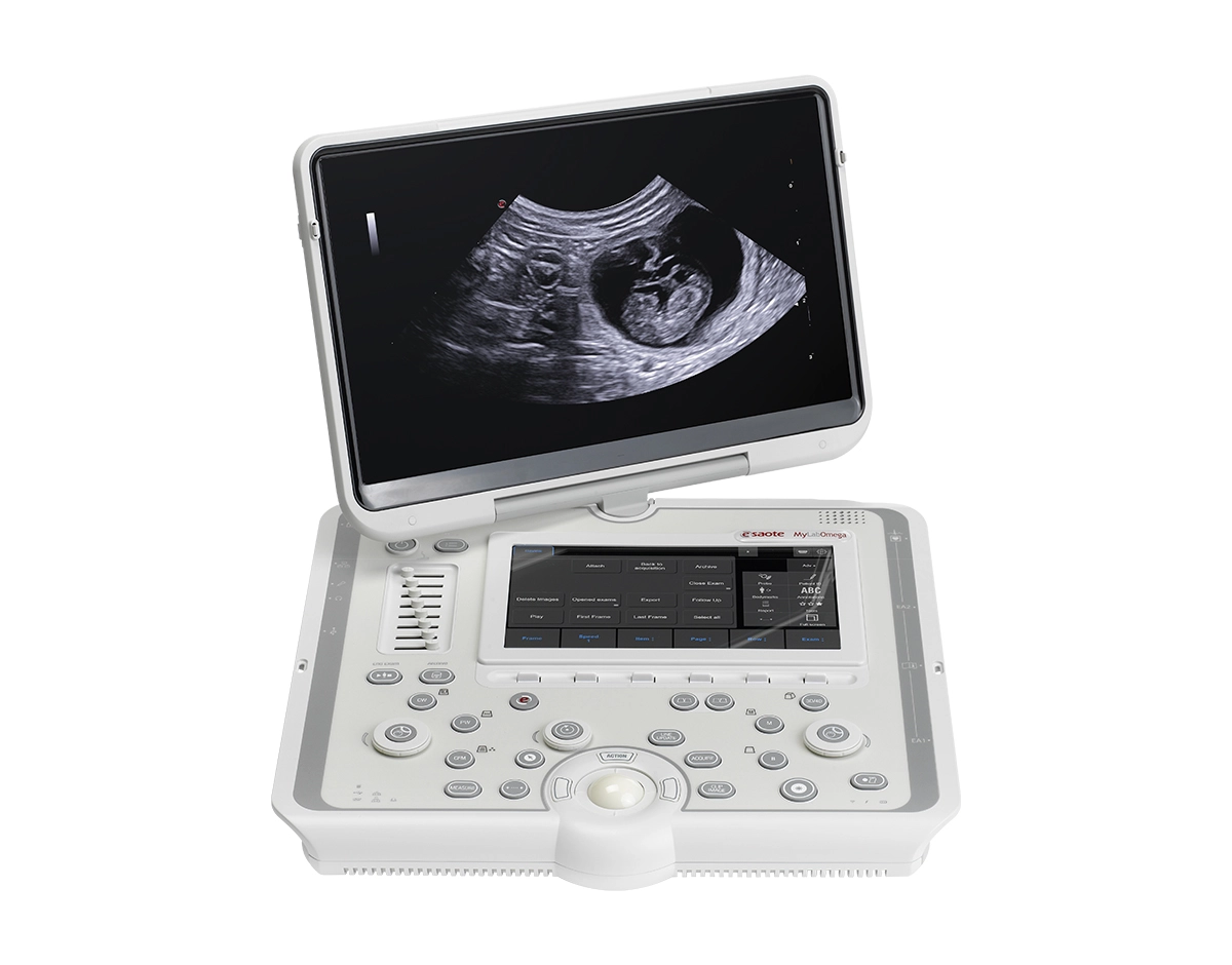 MyLab™OmegaVET premium portable ultrasound system