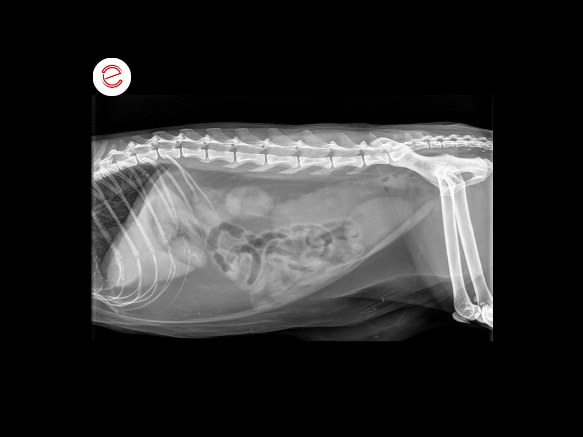 Radiography, increased radiopacity in the descending colon was found, with mild distension of the loops of the small intestine with gaseous content.