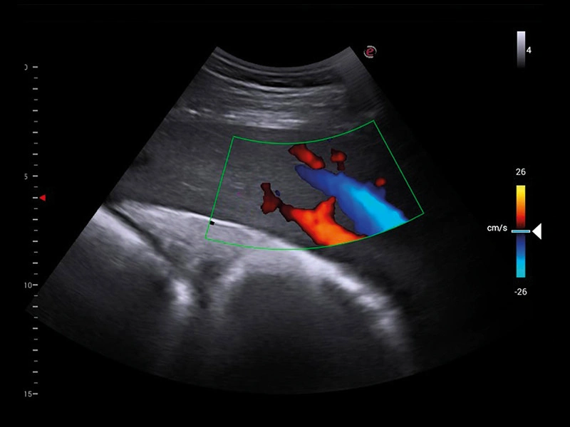 MyLab™X1VET - Equine- liver microvascularization	