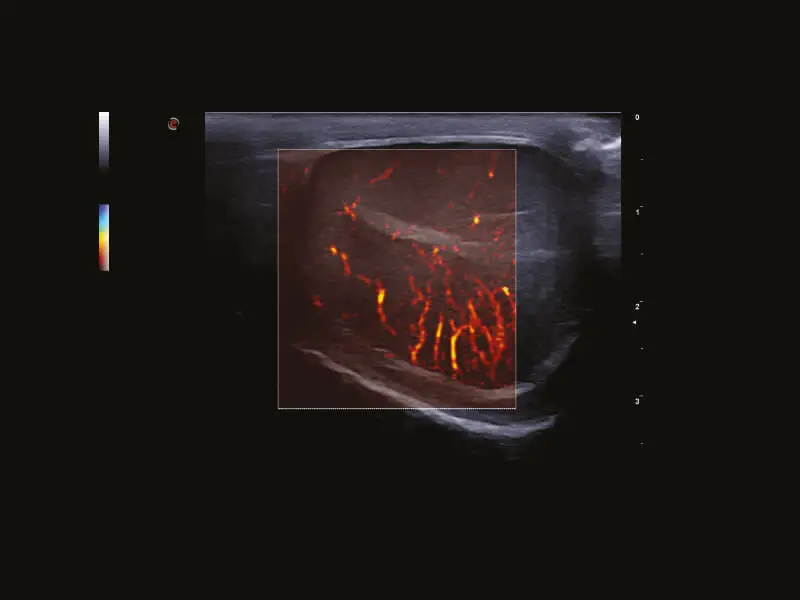 MyLab™Omega eXP VET - Dog - testis vascularization with microV