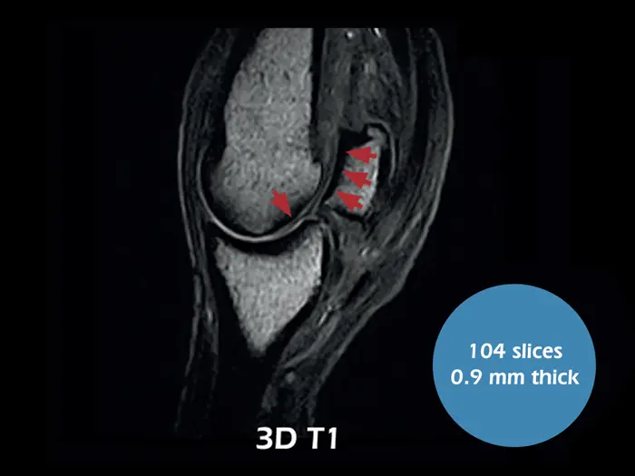 O-scan VET - Fetlock Arthropathy 01